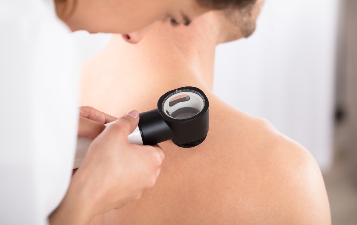 Concilio - Psoriasis : une maladie inflammatoire chronique cutanée