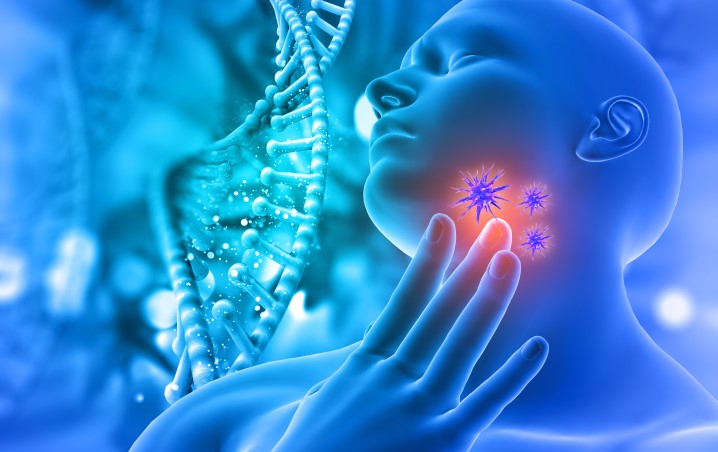 Adénopathie cervicale : pathologie d'un ganglion de la région du cou