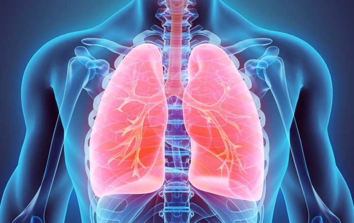 Œdème aigu pulmonaire (OAP)